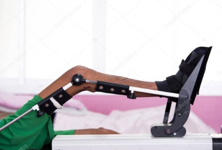 Paziente che utilizza un riabilitatore CPM per arto